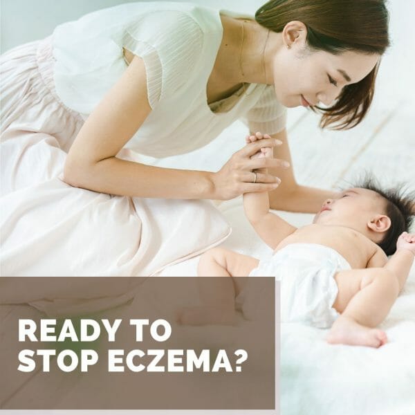 Natural Eczema Solutions Shea Terra